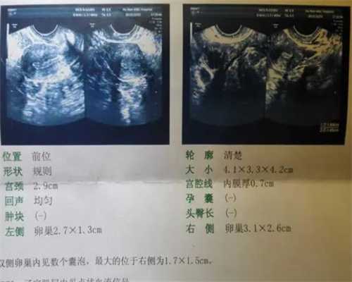 上海哪家医院代生,2023
年上海做试管婴儿的费用可以报医保吗？